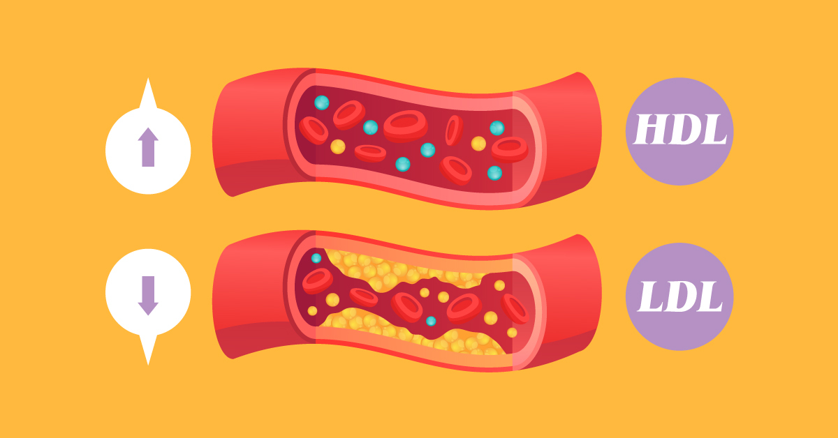 Como reduzir os níveis de colesterol no sangue